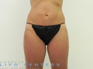 americanlipocenters_60.jpg
